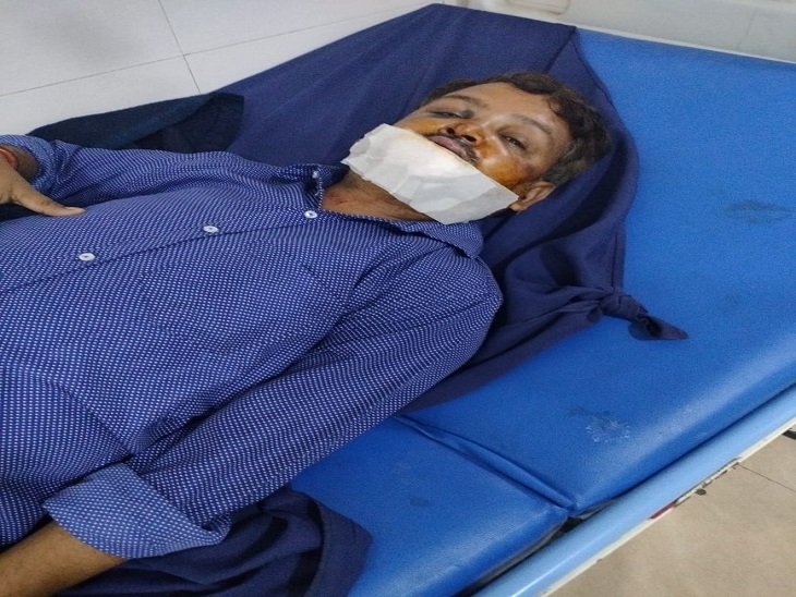 Catastrophe on life: Massive negligence of company: bike rider collided with open major gap of sewer, fell on the bottom, damaged jaw, acquired many stitches