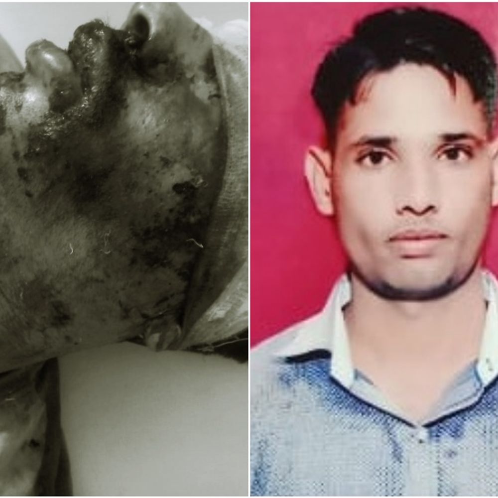 बर्थडे पार्टी में कॉन्स्टेबल की पिटाई:कहासुनी हुई तो दोस्तों ने दिल्ली RAC जवान को बंधक बनाया, बुआ के लड़कों ने छुड़ाया, बीच रास्ते में धारदार हथियार से हमला, मरा समझकर भागे