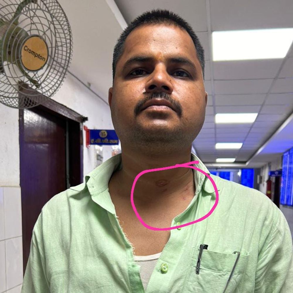 शेखपुरा में FST टीम पर जानलेवा हमला, दो कर्मी घायल:जनसंपर्क अभियान चलाए जाने पर राजद सर्मथकों ने की मारपीट, अर्चना रविदास और विधायक विजय सम्राट पर FIR