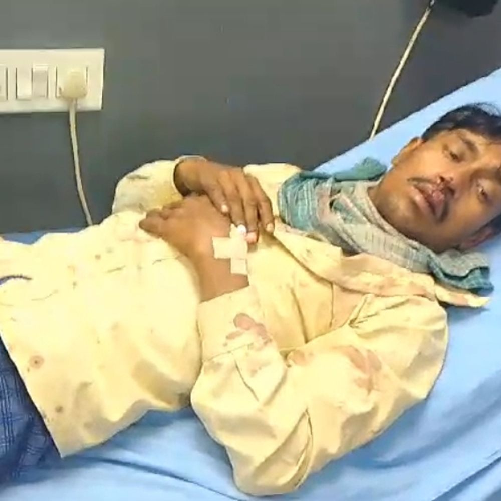 दो पक्षों में हुई जमकर मारपीट, एक दर्जन घायल:दोनों तरफ से जमकर चले लाठी और डंडे, दो की हालत गंभीर