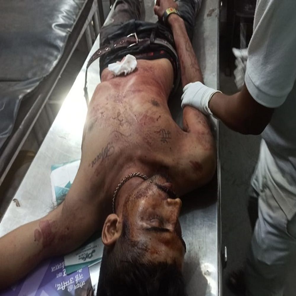 भिलाई में युवक पर चाकू से हमला:खून से लथपथ हालत में दोस्त ने अस्पताल पहुंचाया; प्राथमिक उपचार के बाद दुर्ग रेफर