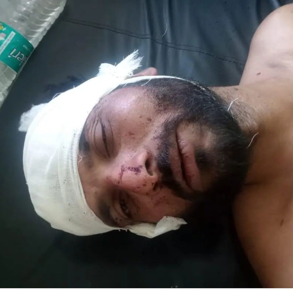 राजगढ़ में ट्रक ड्राइवर से 30 हजार की लूट:डीजल खत्म होने पर रुका, 4 बदमाशों ने तलवार और चाकू से हमला किया