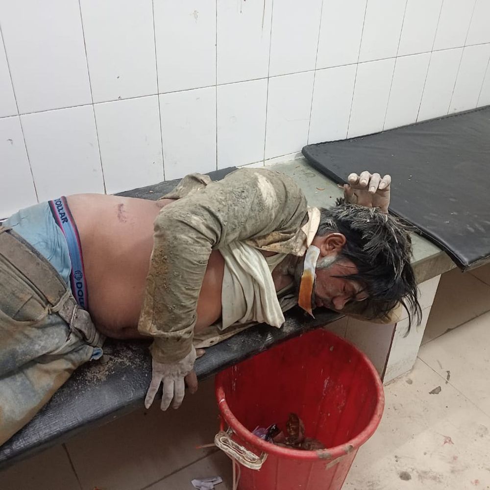 यूपी के महराजगंज में फ्लाईओवर का हिस्सा गिरा:कई मजदूर मलबे में दबे, फरेंदा सीएचसी में चल रहा इलाज