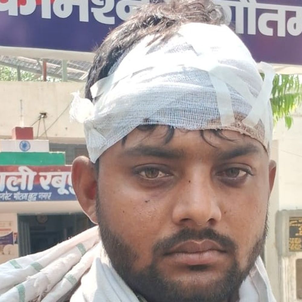 नोएडा में पिकअप निकालने को लेकर विवाद:लाठी-डंडों से हमला, 4 लोग घायल; एक युवती समेत 4 पर केस दर्ज