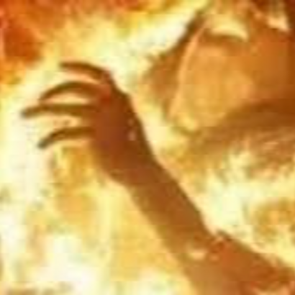 आजमगढ में आग से झुलसे वृद्ध की जौनपुर में मौत:सोते समय मच्छरदानी में आग लगने से झुलसे रामकरन का चल रहा था इलाज, दो संदिग्ध हिरासत में
