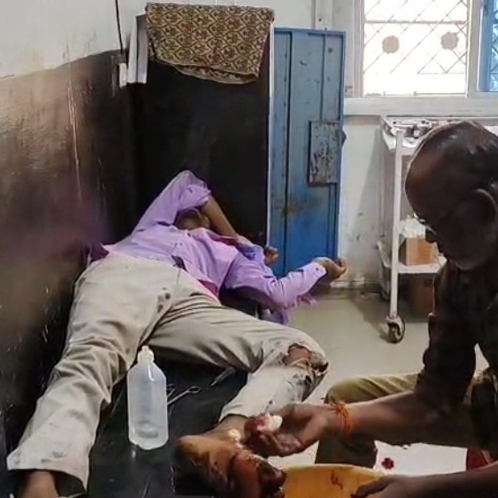 सिवनी में दो बाइक की टक्कर; तीन लोग घायल:दो की हालत गंभीर; जबलपुर मेडिकल कॉलेज रेफर, जमोडी गांव के पास हादसा