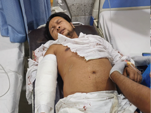 एक्सीडेंट के बाद भी परिवार के लिए फिक्रमंद थे पवनदीप:डॉक्टर ने बताई पूरी कहानी, भाई का नंबर देकर कहा- कोई घर पर बता दो