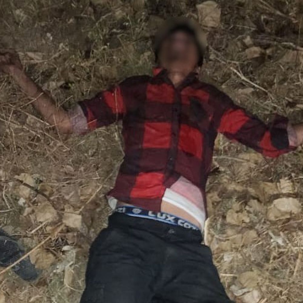 मिर्जापुर में चेन स्नैचर्स की पुलिस से मुठभेड़:भदोही के दो बदमाश गिरफ्तार, एक के पैर में लगी गोली; आरक्षी भी घायल