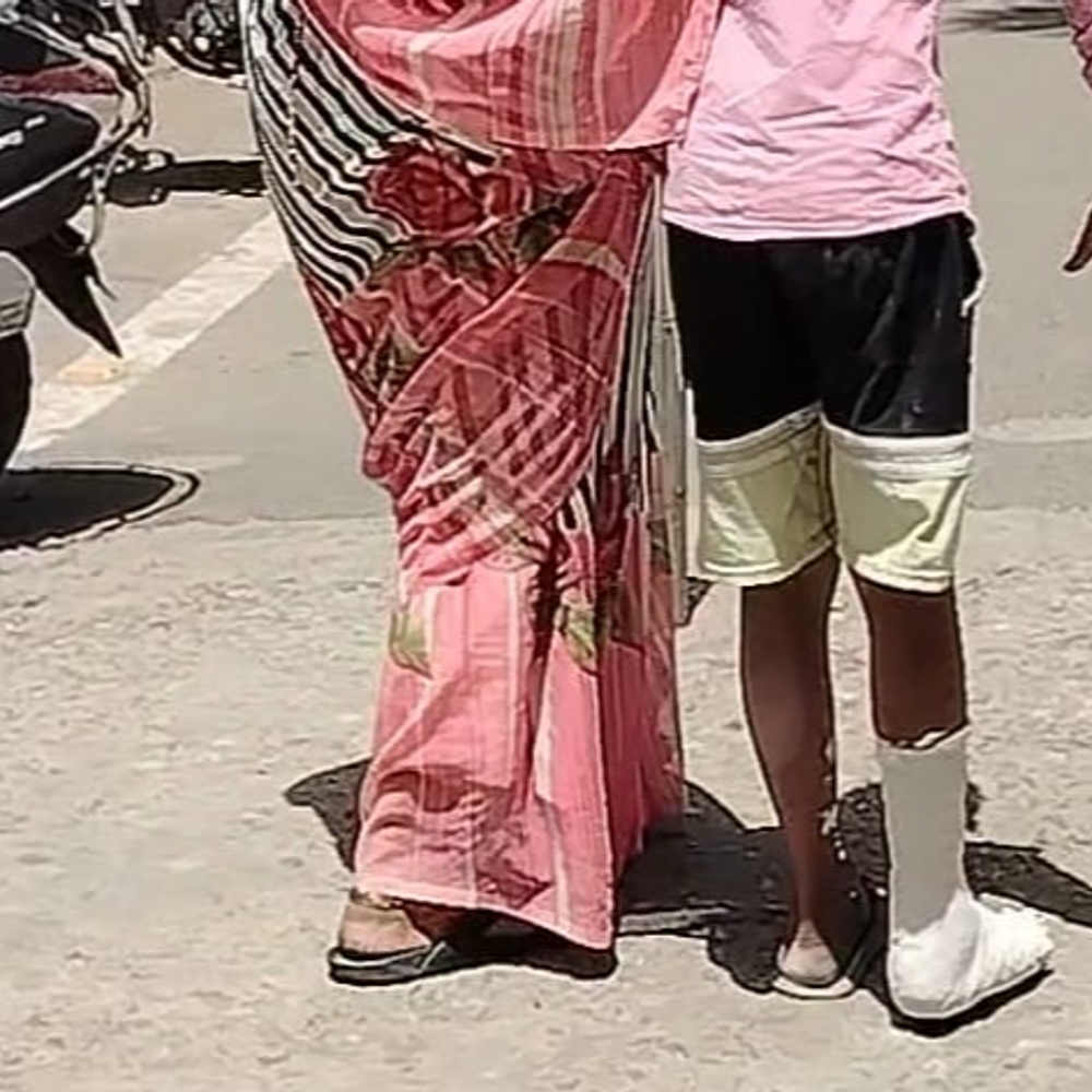 आगरा जिला अस्पताल दो व्हीलचेयर पर निर्भर:मरीजों को नहीं मिलती हैं व्हीलचेयर, परिजनों के सहारे से जाते हैं इलाज के लिए