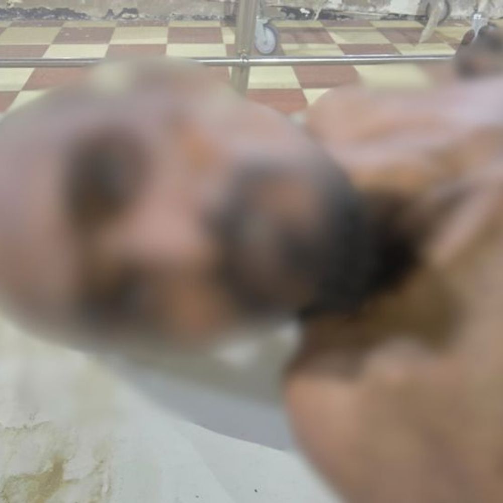 उन्नाव में कानपुर-लालगंज हाईवे पर मिला अज्ञात शव:बस स्टॉप पर तबीयत बिगड़ने से हुई मौत, शिनाख्त में जुटी पुलिस