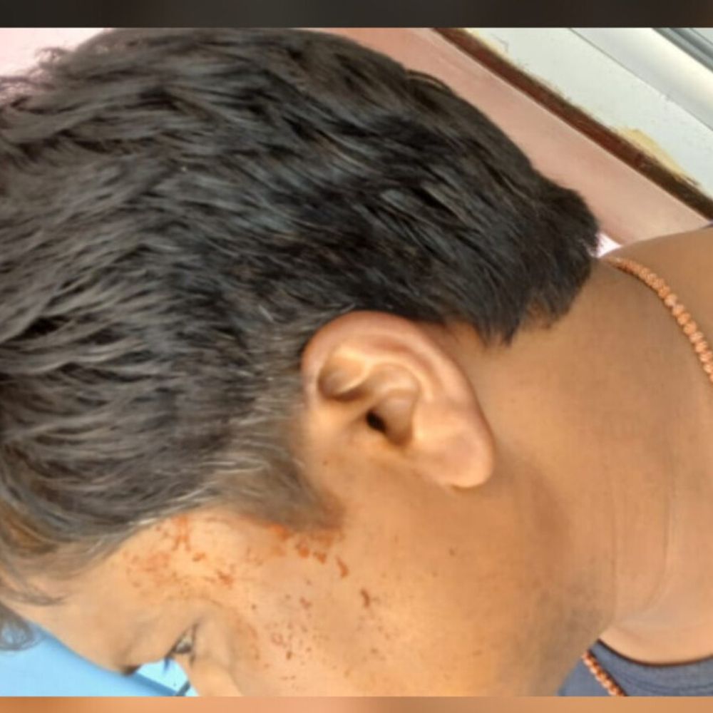 बीकेटी में पति-पत्नी से मारपीट:पड़ोसियों ने लाठी-डंडों से किया हमला, जेवर छीनने का आरोप
