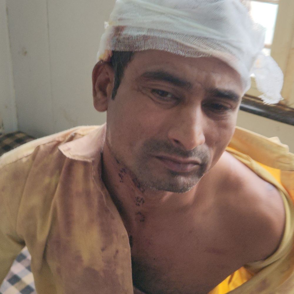 महिला ने ससुरालवालों के साथ पति को लाठी-डंडों से पीटा:मंगलसूत्र को लेकर हुआ विवाद; पति का आरोप- घर आने से रोकती है पत्नी