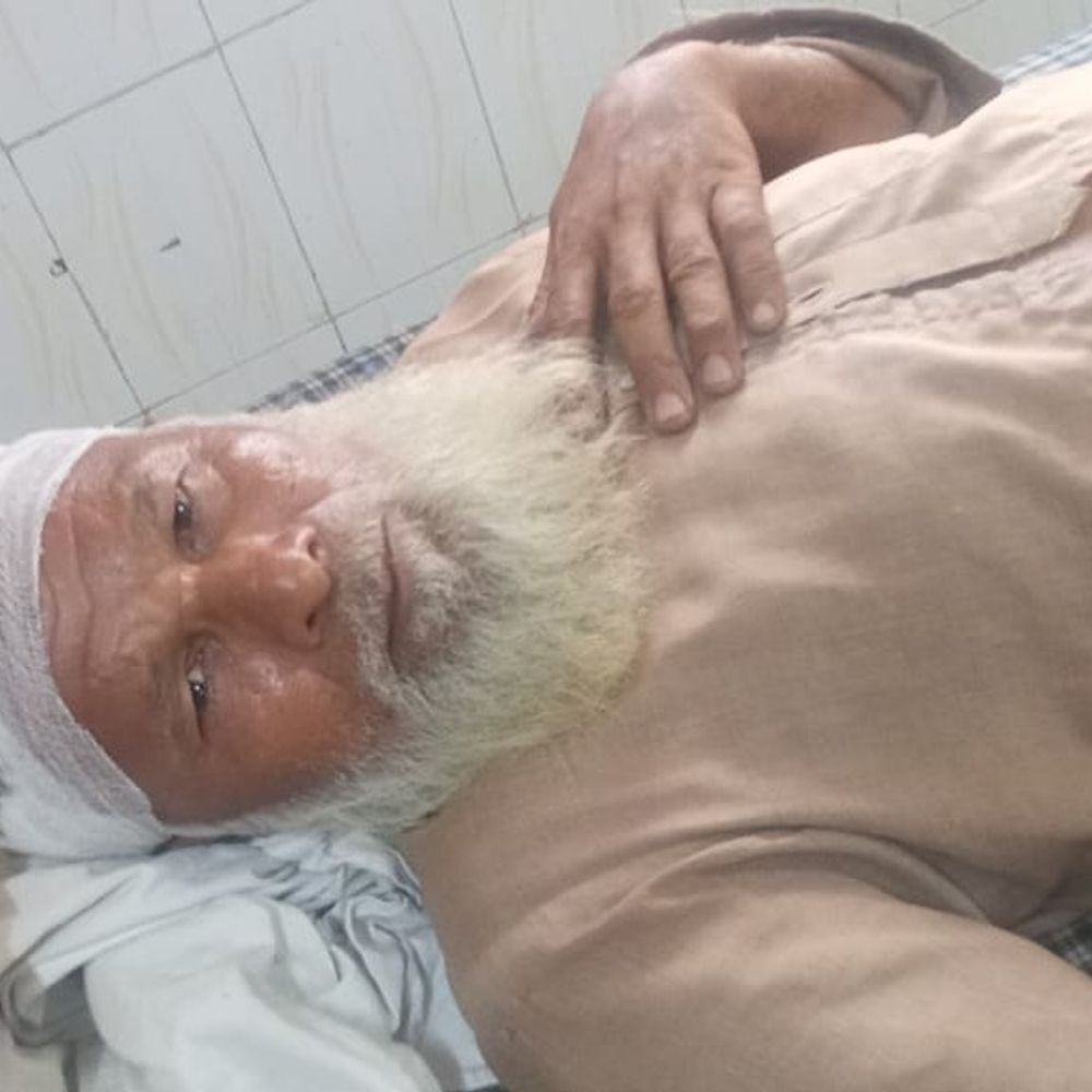 मेरठ में खेत की मेड़ काटने पर विवाद:दबंगों ने बुजुर्ग पर दराती और लाठी-डंडों से किया हमला, अस्पताल में भर्ती