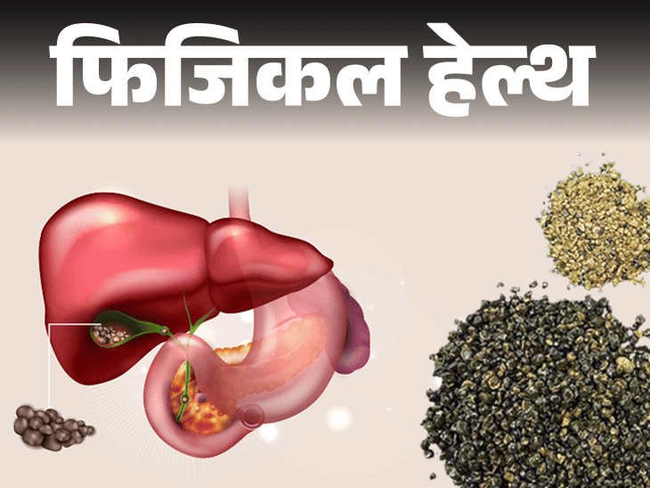 फिजिकल हेल्थ- मरीज के गॉल ब्लैडर से निकलीं 8125 पथरी:इन 10 लोगों को स्टोन का रिस्क ज्यादा, डॉक्टर से जानें कारण व बचाव के तरीके