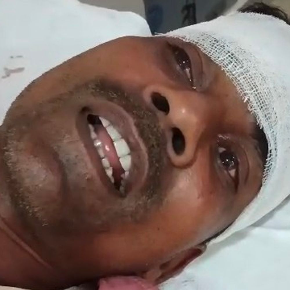 बैजनाथपुर कला में मारपीट का मामला:पीड़त ने की सुरक्षा की मांग, आरोपियों पर मुकदमा दर्ज