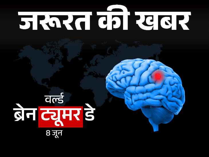जरूरत की खबर- सिगरेट पीने में भारत दूसरे नंबर पर:स्मोकिंग से बढ़ता ब्रेन ट्यूमर का रिस्क, डॉक्टर से जानें इलाज और बचाव