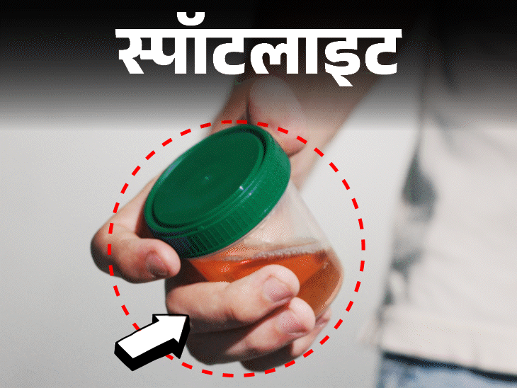 स्पॉटलाइट- इंसानी मूत्र से होगा दांतों और हड्डियों का इलाज:साइंटिस्ट्स को कैसे आया ये आइडिया, देखें वीडियो