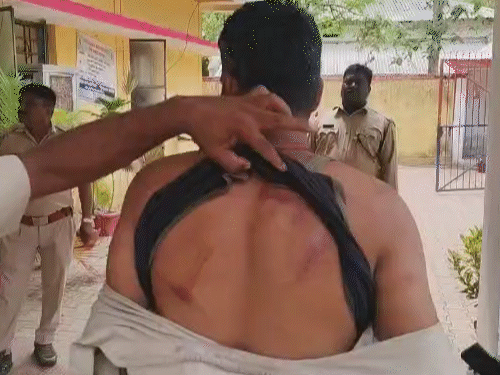 वनकर्मियों को 60 ग्रामीणों ने दौड़ा-दौड़ा कर पीटा:बालोद में डिप्टी रेंजर समेत 4 घायल; 5 महिलाएं भी जख्मी, वन-भूमि को अपना बता रहे