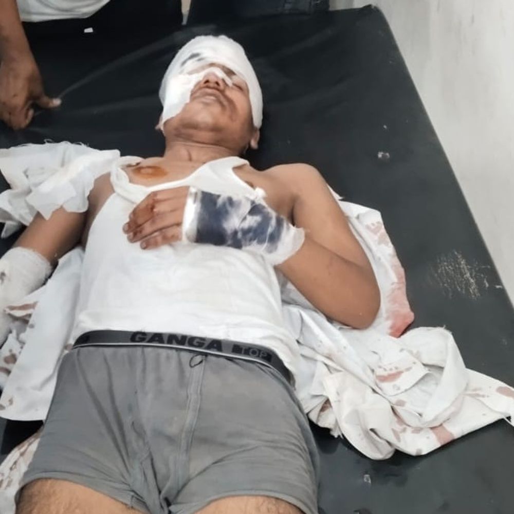 दो बाइकों की टक्कर में 5 युवक घायल:हरदोई में 2 की हालत गंभीर, रेसिंग के दौरान हादसा