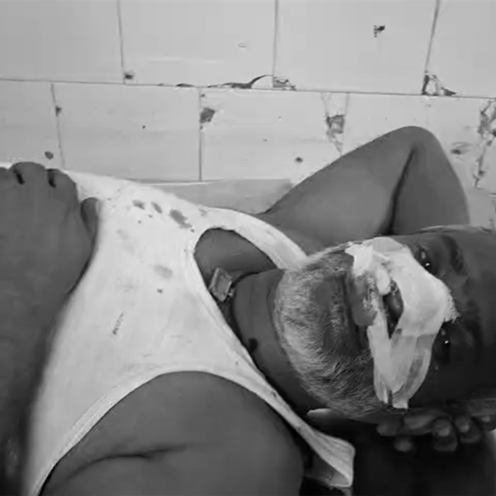 8 फीट जमीन के लिए हमलाकर दर्जी को किया जख्मी:पहले पिस्टल तानी, फिर गला रेतने की कोशिश की; आखिर में चाकू से काट डाली नाक