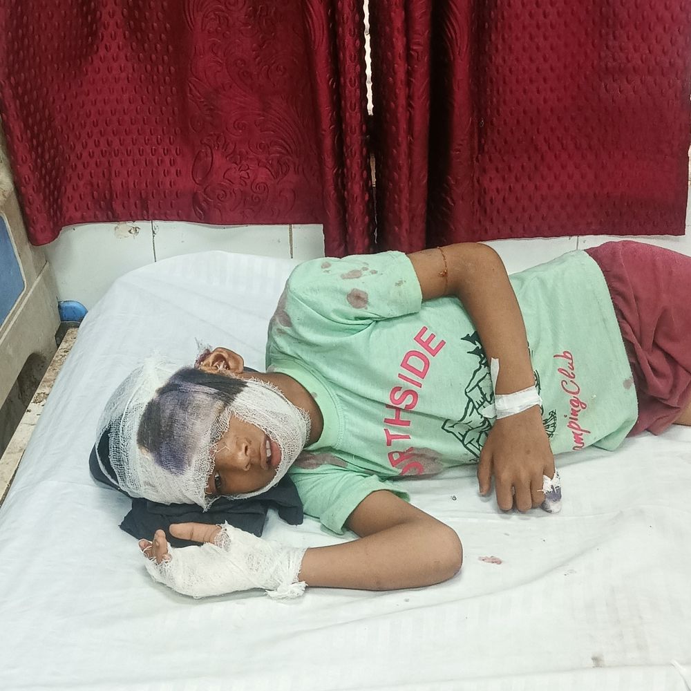 हाथरस में मकान का छज्जा गिरा:महिला सहित चार लोग घायल; वृद्धा को अलीगढ़ किया गया रेफर