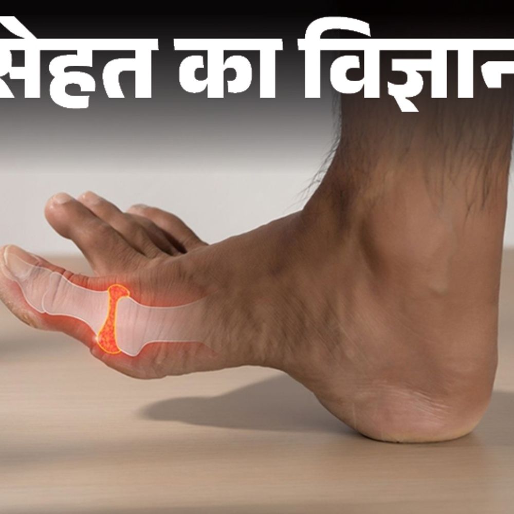 सेहत का विज्ञान- यूरिक एसिड बढ़ा तो गाउट का खतरा:इसे बैलेंस कैसे रखें, कंट्रोल में रखने के पांच कारगर तरीके