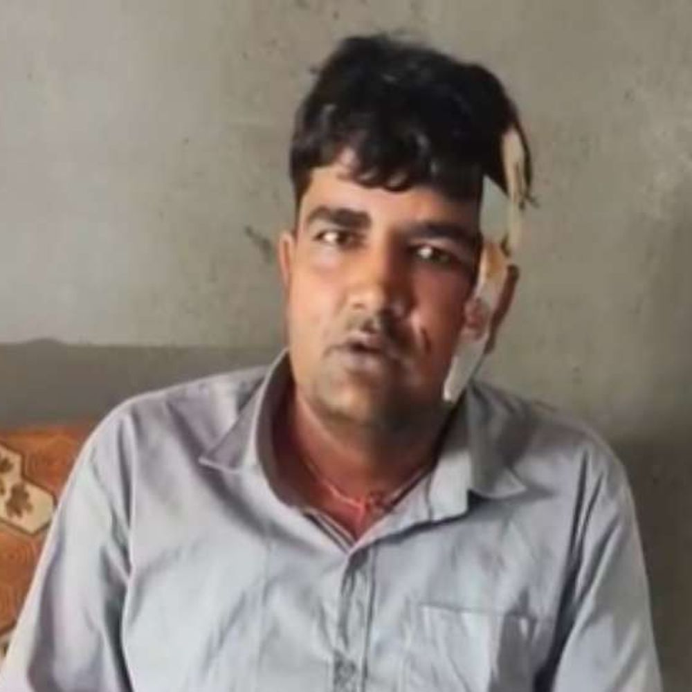 जयपुर में लोहे की रॉड से हमला, दुकानदार को लूटा:घर लौटते समय बीच सड़क पर रोका, बाइक और कैश छीनकर भागे बदमाश