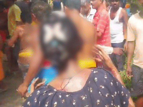 ‘जलती लड़की दरवाजे पर गिरी, बोली- भैया बचा लो’:तीन अनजान लड़कों ने हाथ-पैर बांधकर जलाया, दो दिन बाद भी पुलिस खाली हाथ