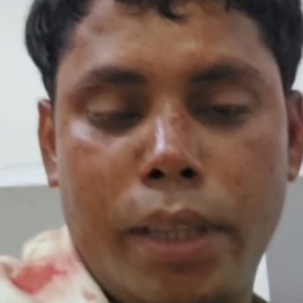 विंध्याचल में दक्षिणा बंटवारे को लेकर मारपीट:कैंची से हमले में एक युवक घायल, 3 आरोपी गिरफ्तार