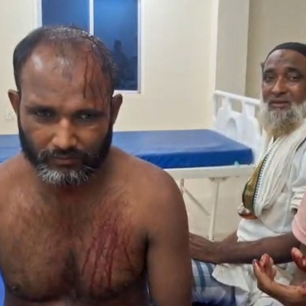 भागलपुर में 2 गुट आपस में भिड़े, चले लाठी-डंडे:दिव्यांग समेत चार लोग घायल, एक-दूसरे पर मोटर चोरी करने का लगाया आरोप