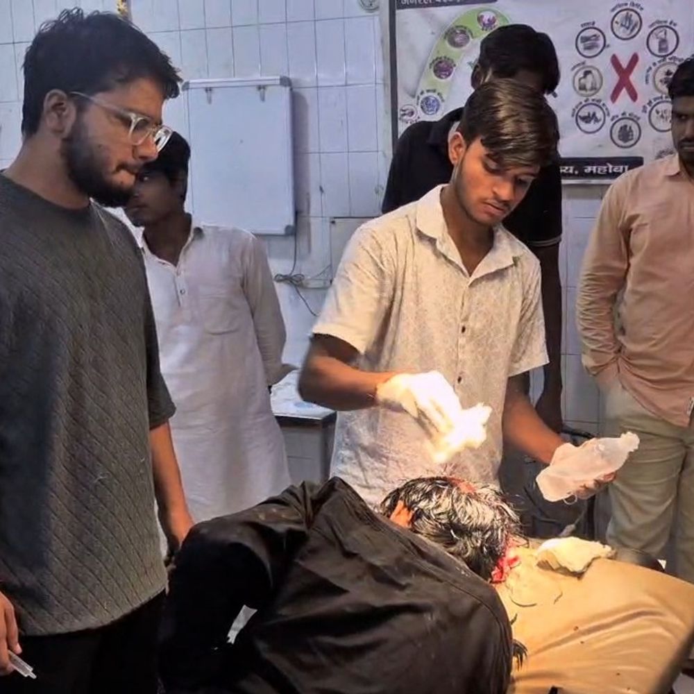 महोबा में शराबी दबंगों का आतंक:किशोर पर लोहे की रॉड से हमला, सिर पर लगे 5 टांके; पुलिस जांच में जुटी
