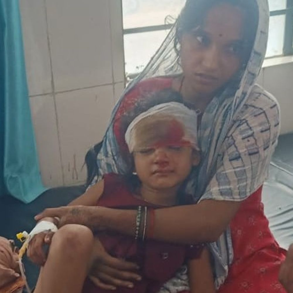 मेसौढा में दीवाल ढहने से 4 बच्चे दबे:एक बच्चे की हालत गंभीर, तीन का अस्पताल में चल रहा इलाज