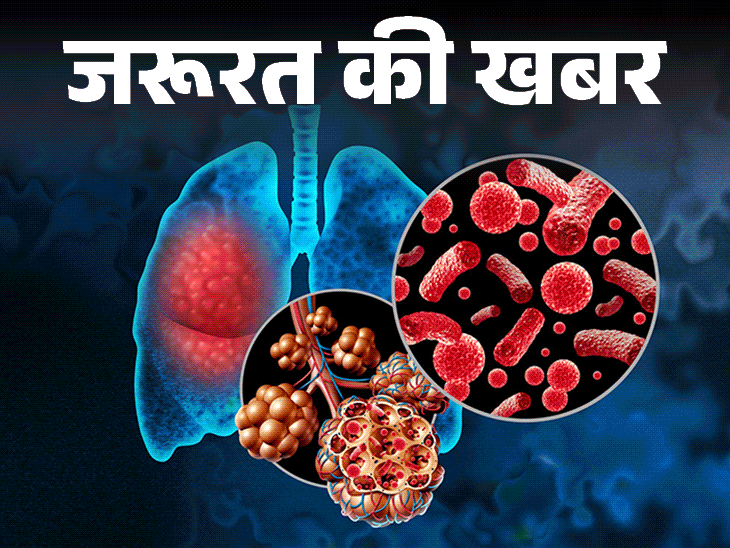जरूरत की खबर- मानसून में बढ़ती निमोनिया की रिस्क:इन 7 लक्षणों को न करें इग्नोर, डॉक्टर से जानें बचाव की 11 आसान टिप्स