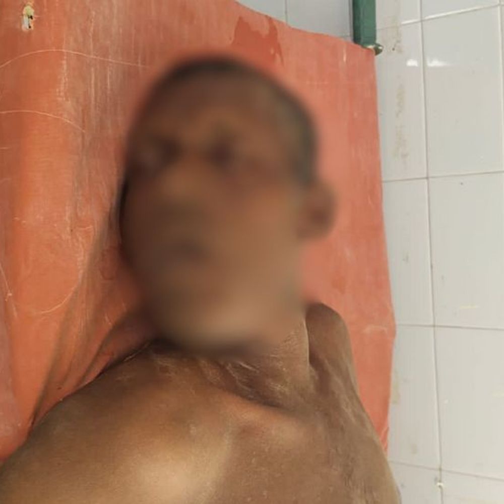 बाराबंकी में हाइवे किनारे मिले व्यक्ति की मौत:सीएचसी में इलाज के दौरान तोड़ा दम, शिनाख्त नहीं