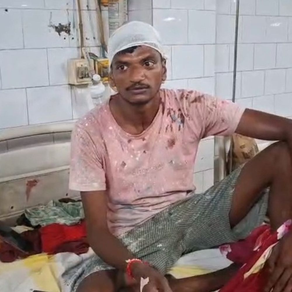 भागलपुर में आपसी विवाद में 2 गुट भिड़े:मारपीट में एक ही परिवार के चार लोग घायल, पीड़िता बोली- पड़ोसी से कुल्हाड़ी से किया हमला