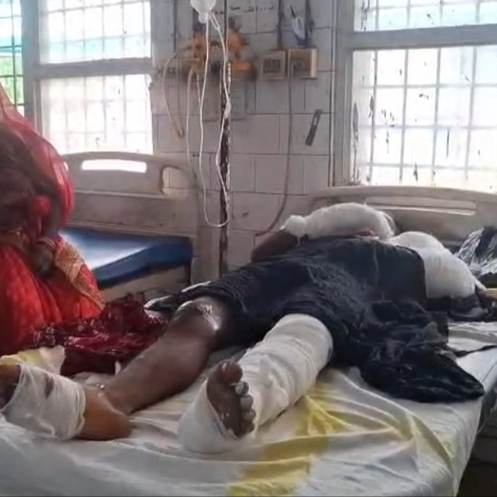 भागलपुर में बाइक की टक्कर से हाथ-पैर टूटा:मेला देख कर लौट रहा था युवक, मोटर साइकिल की टक्कर से हुआ जख्मी