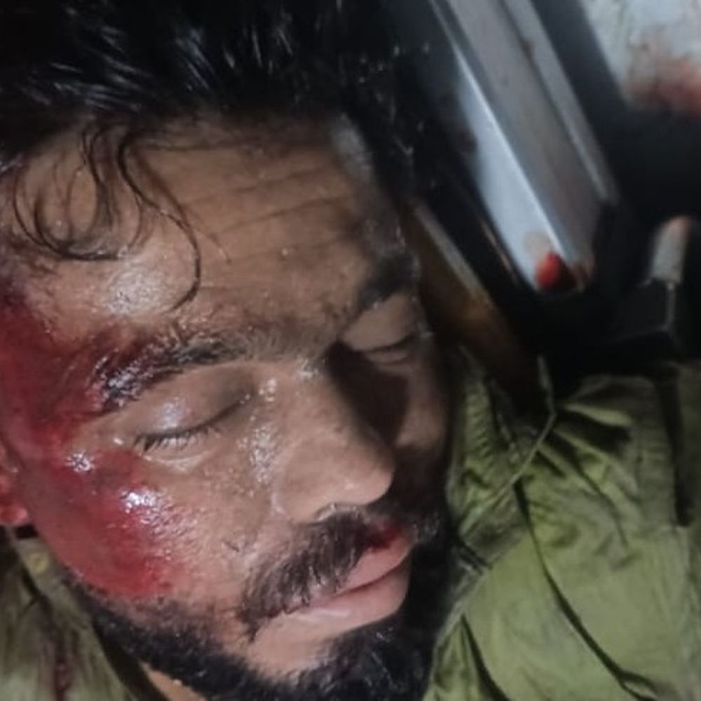 कार ने बाइक सवार को मारी टक्कर, 2KM तक घसीटा:बाराबंकी में अस्पताल में युवक की मौत, मौके से भागा चालक