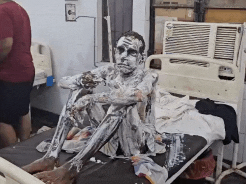 आगरा में गैस सिलेंडर लीक से घर में लगी आग:एक ही परिवार के 14 लोग झुलसे, सामान जलकर हुआ राख