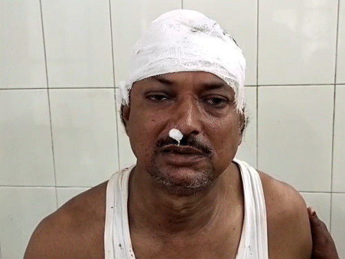 समस्तीपुर में भतीजे ने चाचा को बेरहमी से पीटा:2 साल पहले 90 हजार कर्ज दिया था; रुपए मांगने पर भड़का, सिर फोड़ा