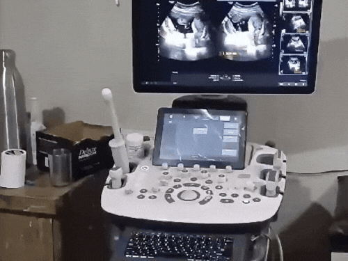 हरियाणा में बेटे की चाहत में विदेश जा रहे दंपती:नेपाल-थाईलैंड में करा रहे भ्रूण लिंग जांच; 9 जिलों पर STF की नजर