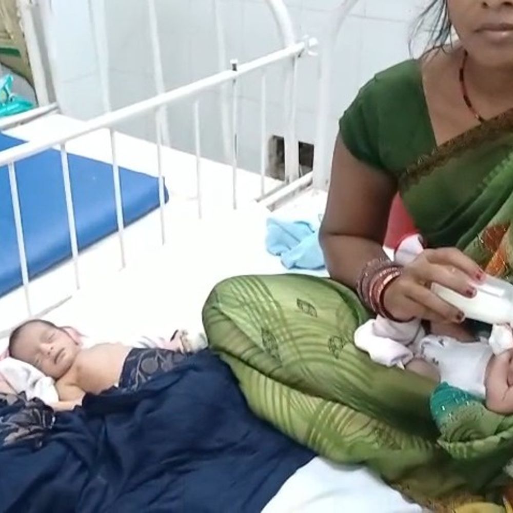 बनकटा में एक महिला ने दिया 3 बच्चों को जन्म:सात महीने में हुआ असामान्य प्रसव, खबर बनी चर्चा का विषय