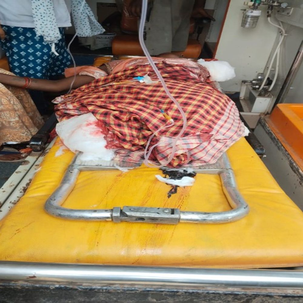 बालोद में ट्रेन की चपेट में आई महिला:  हाथ-पैर कटकर हुए अलग, दर्द से तड़पती रही, गंभीर हालत में राजनांदगांव मेडिकल कॉलेज रेफर – Balod News