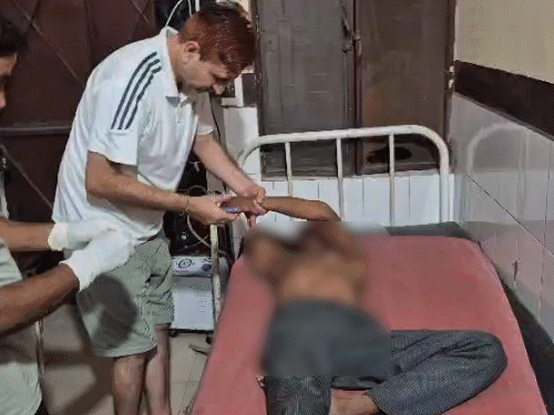 भाई और भतीजे ने बड़े भाई पर पेट्रोल डालकर जलाया:डॉक्टरों ने बड़ौत से मेरठ रेफर किया, आरोपी फरार