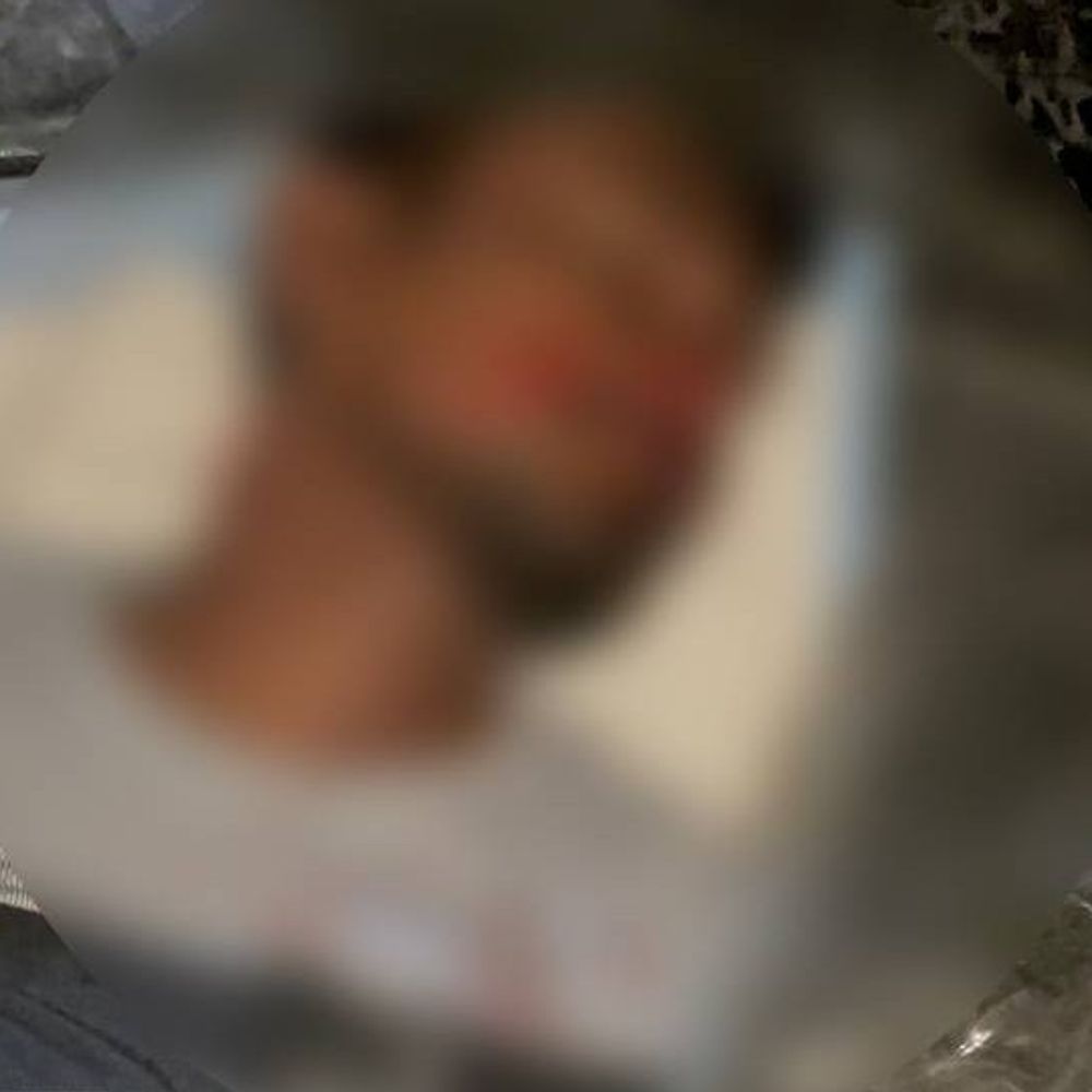 महराजगंज में सड़क किनारे मिला युवक का शव:लाश पर मिले चोट के निशान, परिजनों ने जताई हत्या की आशंका