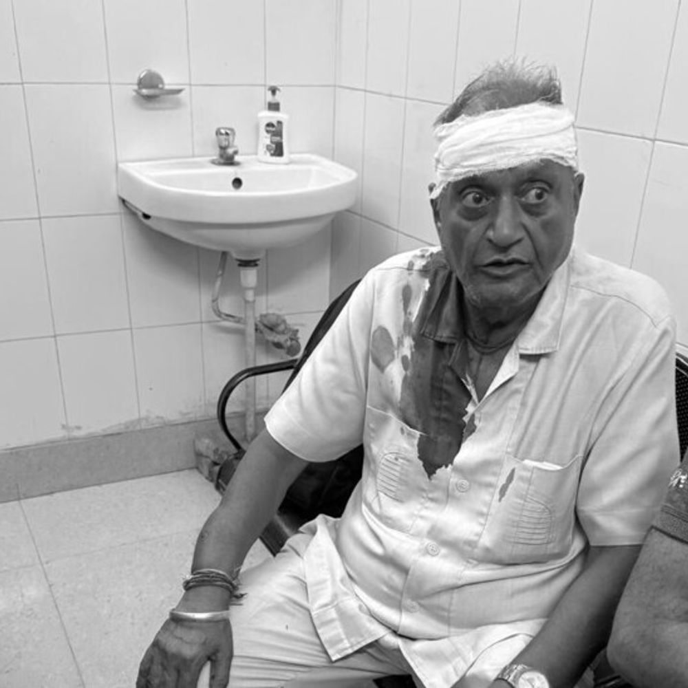 बरनाला में गोशाला कमेटी प्रधान पर हमला:  कॉलेज रोड से घर जा रहे थे; बाइक सवारों ने तेजधार हथियारों से काटा – Barnala News