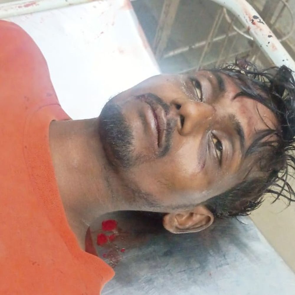देवरिया में ट्रेन से युवक का पैर कटा:दादर एक्सप्रेस की चपेट में आया, मेडिकल कॉलेज रेफर