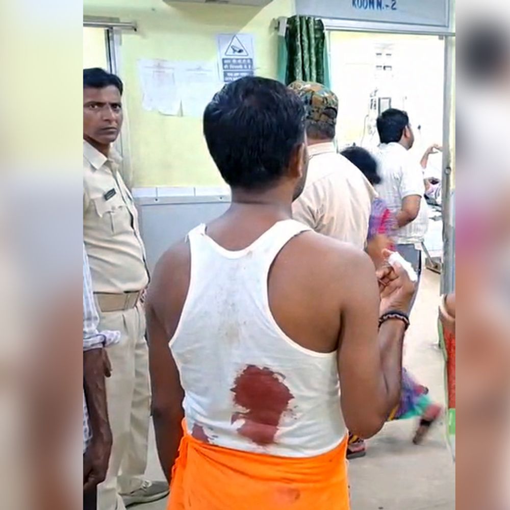 सरायढेला में महिला से छेड़खानी का मामला:  परिवार पर कुल्हाड़ी से हमला, चार घायल अस्पताल में भर्ती – Dhanbad News