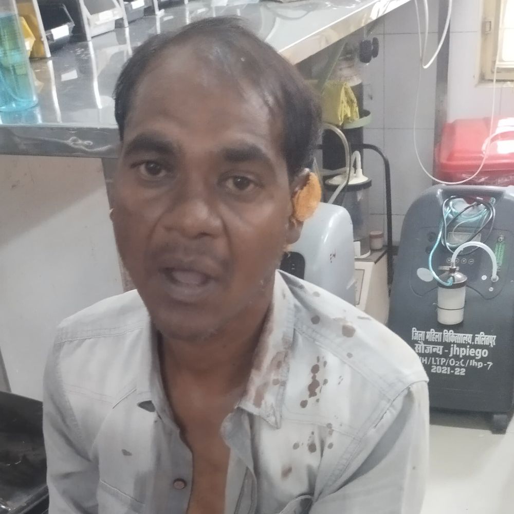 उधार के पैसे मांगने पर युवक का कान काटा:ललितपुर में पिता-पुत्र समेत तीन लोगों ने की मारपीट, मेडिकल कॉलेज में हुई सर्जरी