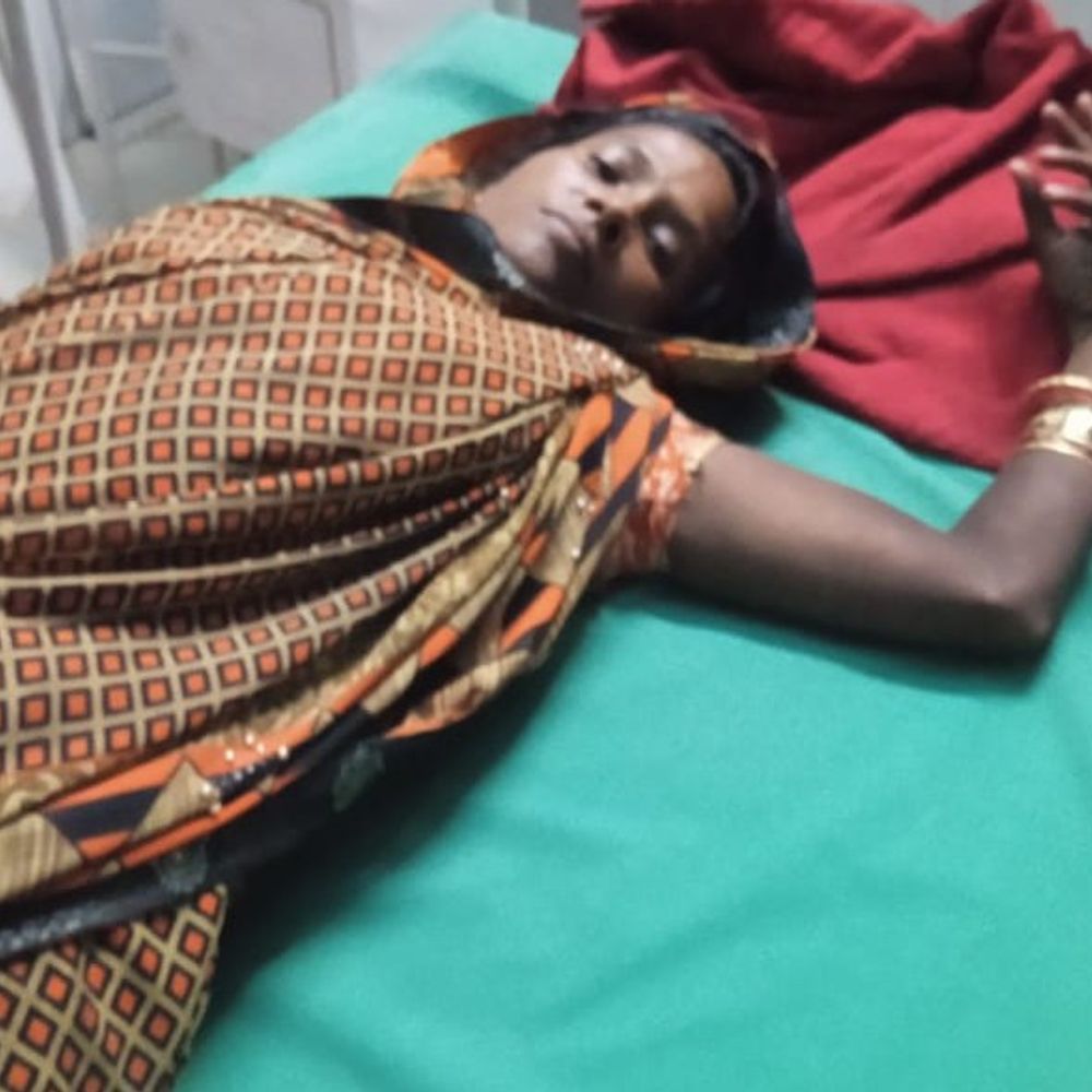 मड़िहान में आकाशीय बिजली का कहर:दो गांवों में तीन लोग झुलसे, सीएचसी में भर्ती; डॉक्टर बोले- खतरा टला