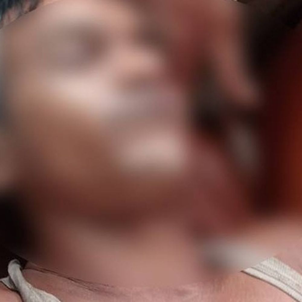 मिर्जापुर में सांप के काटने से मैकेनिक की मौत:झाड़-फूंक कराने में गवांया समय, अस्पताल ले जाते समय तोड़ा दम
